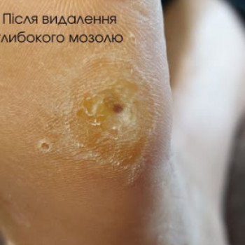 Оксана Завьялова, Киев Фото - 4