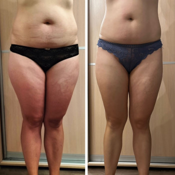 Каріна Танорпольська, Белая Церковь Фото - 3