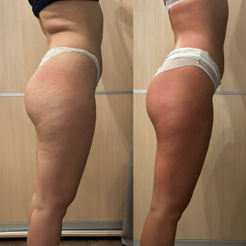 Каріна Танорпольська, Белая Церковь Фото - 5