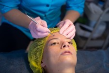 Комбінована чистка обличчя для студентів Косметолог-естетист Людмила Харків