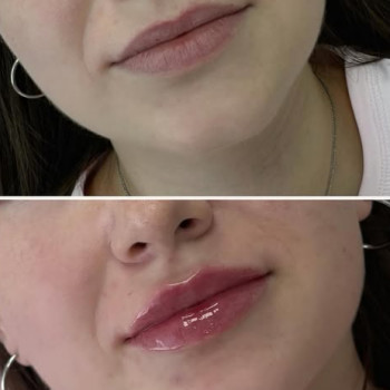 Яна Тараненко, Белгород-Днестровский Фото - 5