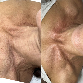 Ирина Левченко, Белгород-Днестровский Фото - 5