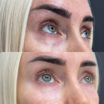 Любов Чумаченко, Запоріжжя Фото - 4