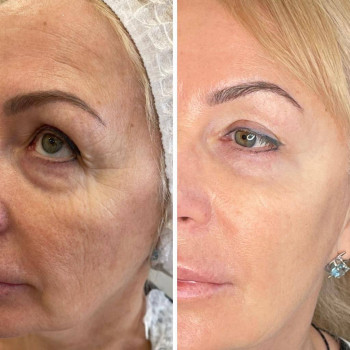 Любов Чумаченко, Запоріжжя Фото - 5