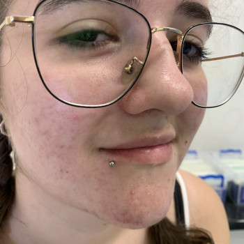 Пірсинг Лабрет