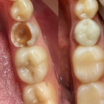 Юлия Завьялова, Белгород-Днестровский Фото - 5