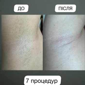 Лілія Свєчнікова, Київ Фото - 5