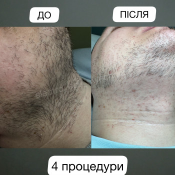 Лілія Свєчнікова, Київ Фото - 6