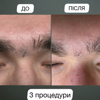 Лілія Свєчнікова, Київ Фото - 7