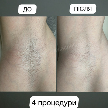 Лілія Свєчнікова, Київ Фото - 8