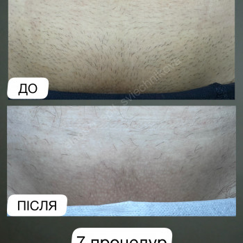 Лілія Свєчнікова, Київ Фото - 9