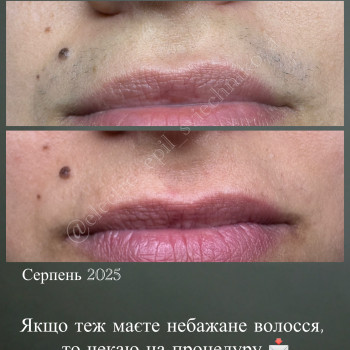 Лілія Свєчнікова, Київ Фото - 10