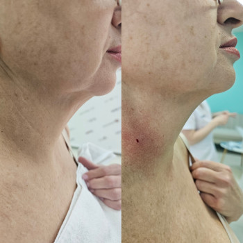 Оксана Татаєва, Одеса Фото - 3