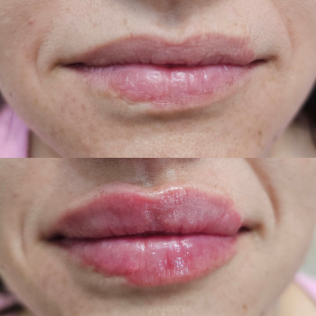 Оксана Татаєва, Одеса Фото - 5