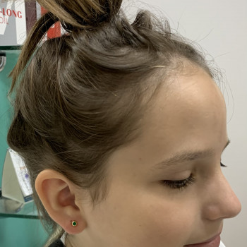 Прокол мочок вушок дітям