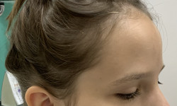 Пірсинг мочок вух Мастер по пирсингу Татьяна Киев