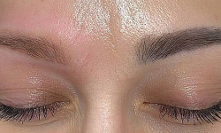 Лазерне видалення татуажу та татуювань Мастер перманентного макияжа Катерина Киев