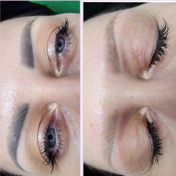 Лазерне видалення татуажу та татуювань
                    Мастер перманентного макияжа Катерина Киев