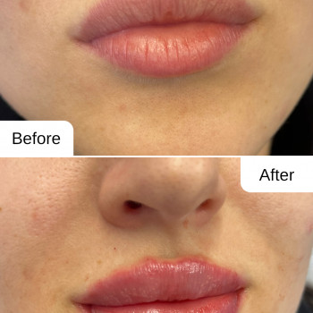 Зволоження губ