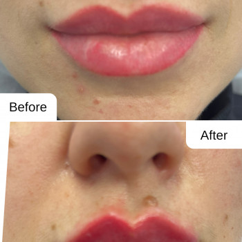 Зволоження губ