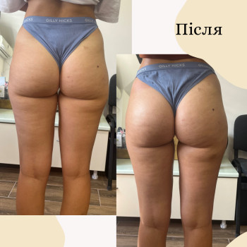 Комплексна робота із контурами тіла