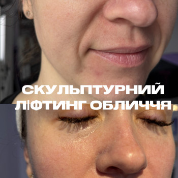 Божена Дорощук, Ровно Фото - 2