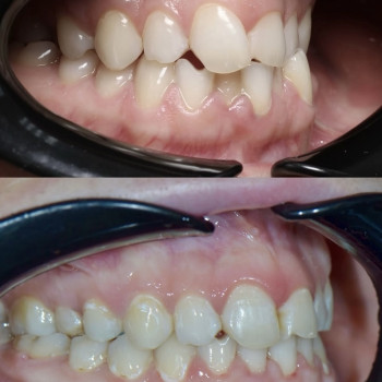 Function Dental Clinic, Ровно Фото - 5