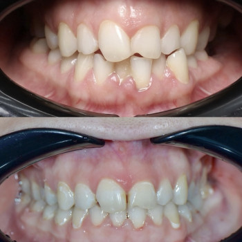 Function Dental Clinic, Ровно Фото - 6