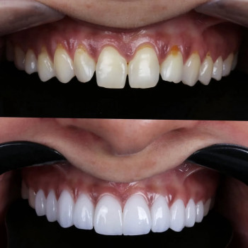 Function Dental Clinic, Ровно Фото - 7