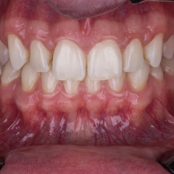 Function Dental Clinic, Ровно Фото - 11