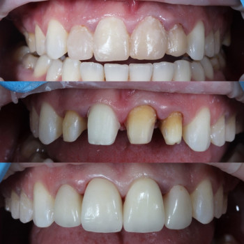 Олег Качмар, Львов Фото - 4