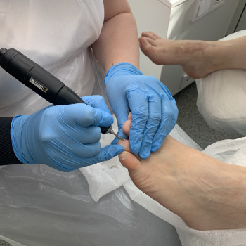 Медичний педикюр