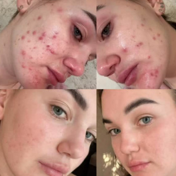 Ксенія Коростеліна, Олександрія Фото - 5