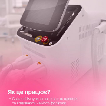 ЕЛОС - система
 