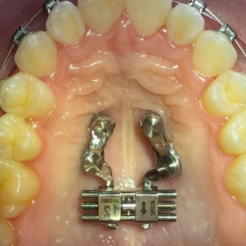 VIODent, Александрия Фото - 5