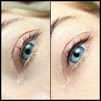 Міжвійка до\після