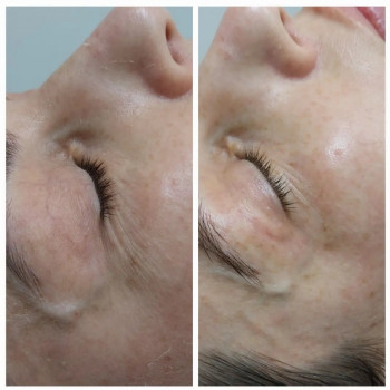 Оксана Соколовська, Ирпень Фото - 14