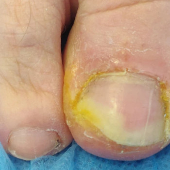 Лида Мирзаханова, Светловодск Фото - 5