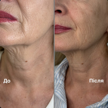 Джульета Хачатрян, Кривой Рог Фото - 4