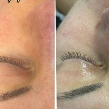 Face and Body, Знам'янка Фото - 5