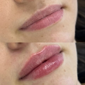 Ірина Чепурна, Рівне Фото - 5