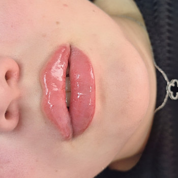 Фото из портфолио косметолога Любовь Черней (Запорожье)