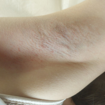 Павленко Тетяна, Кагарлик Фото - 11