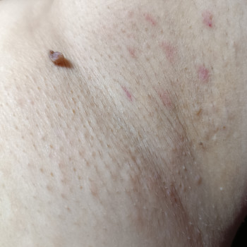 Галина Ковальська ТАНАСІЇВНА, Черновцы Фото - 6