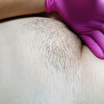 Галина Ковальська ТАНАСІЇВНА, Черновцы Фото - 7