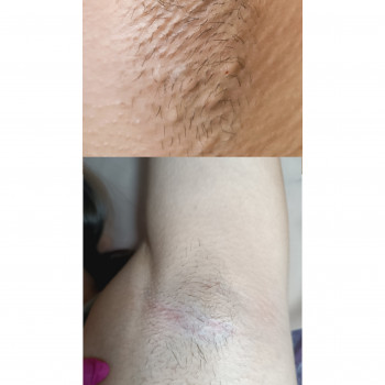 Галина Ковальська ТАНАСІЇВНА, Черновцы Фото - 8