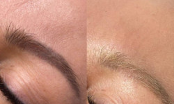 Лазерное удаление перманента и татуировок безопасно Мастер перманентного макияжа Людмила Черноморск