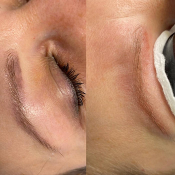 Лазерное удаление перманента и татуировок безопасно
                    Мастер перманентного макияжа Людмила Черноморск