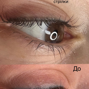 Видалення стрілки лазером
                    Майстер перманентного макіяжу Ирина Полтава