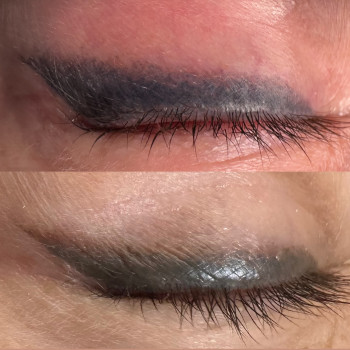 Видалення стрілки лазером
                    Майстер перманентного макіяжу Ирина Полтава